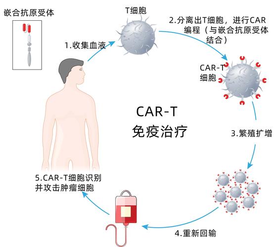 疾病临床症状消失CAR-T疗法展现治疗多种自身免疫疾病潜力